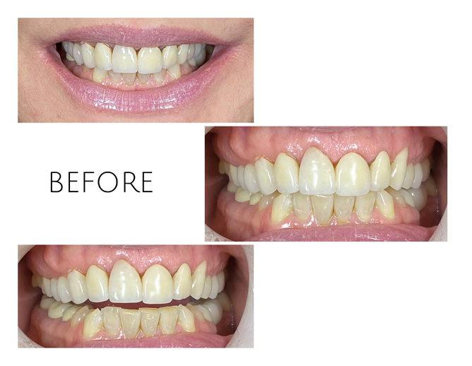 Smile Gallery Before Image