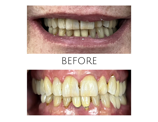 Smile Gallery Before Image