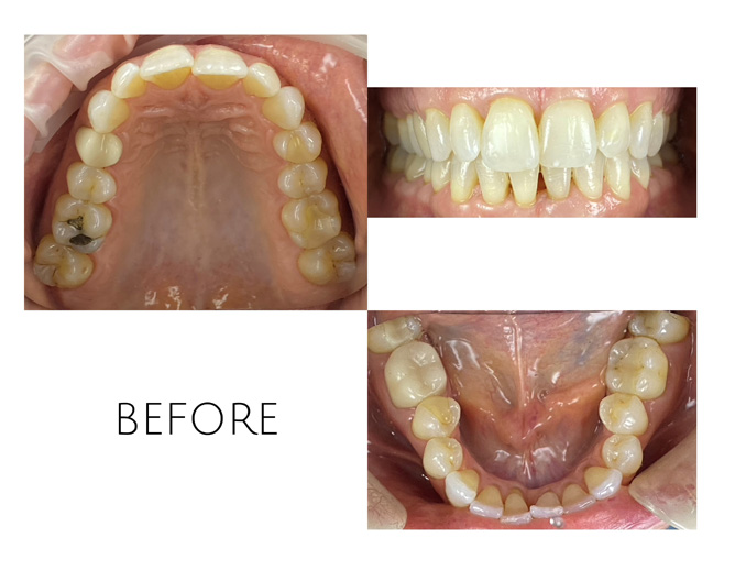 Smile Gallery Before Image