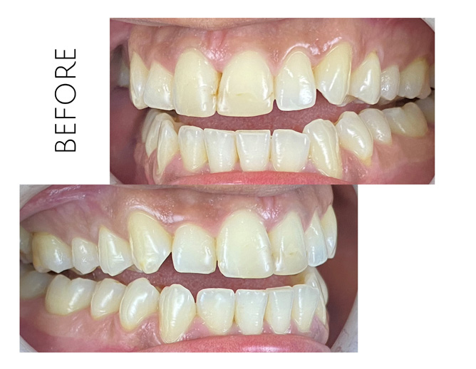 Smile Gallery Before Image