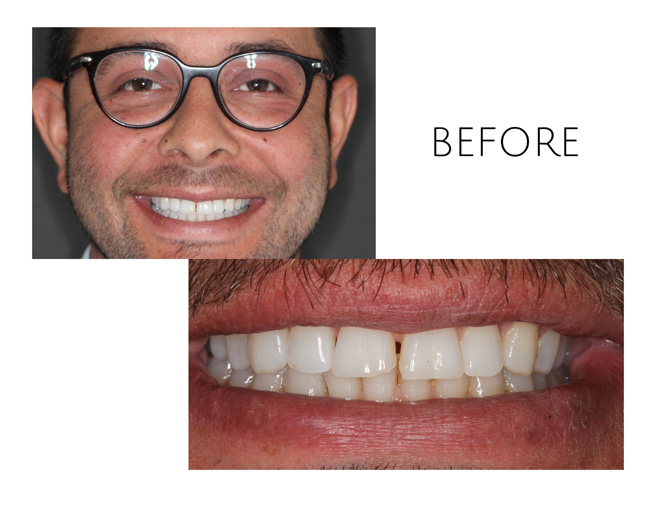 Smile Gallery Before Image