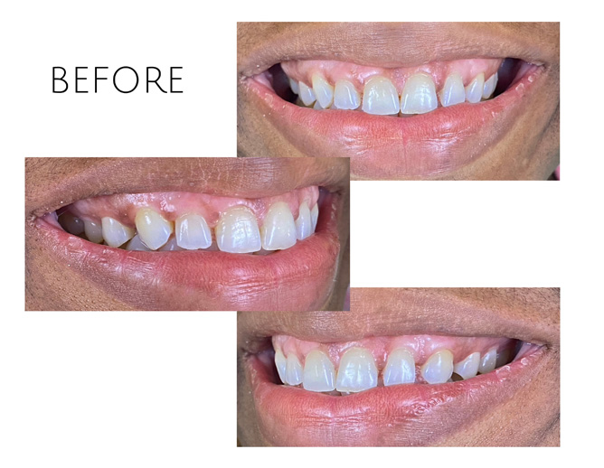 Smile Gallery Before Image