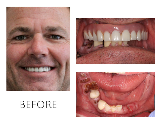 Smile Gallery Before Image