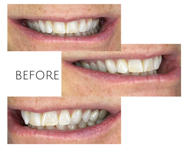 Smile Gallery Before Image