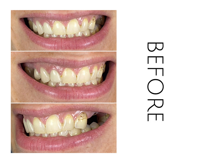 Smile Gallery Before Image