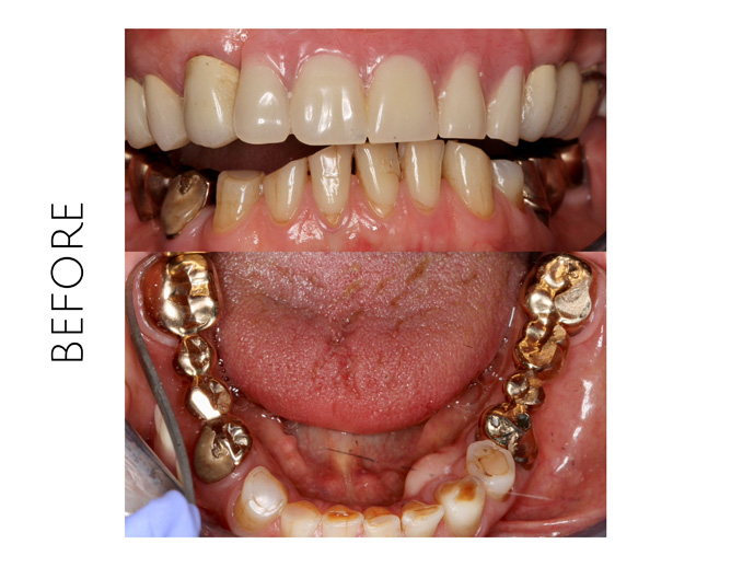 Smile Gallery Before Image