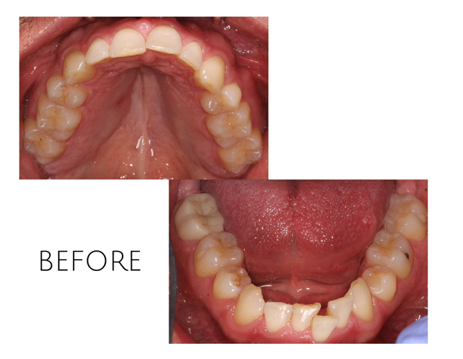 Smile Gallery Before Image