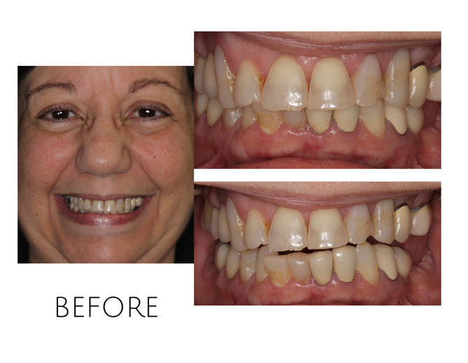 Smile Gallery Before Image