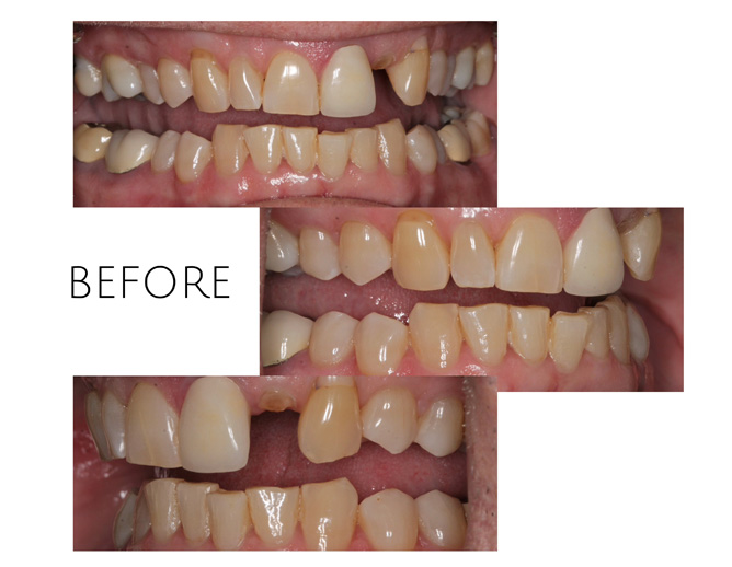 Smile Gallery Before Image