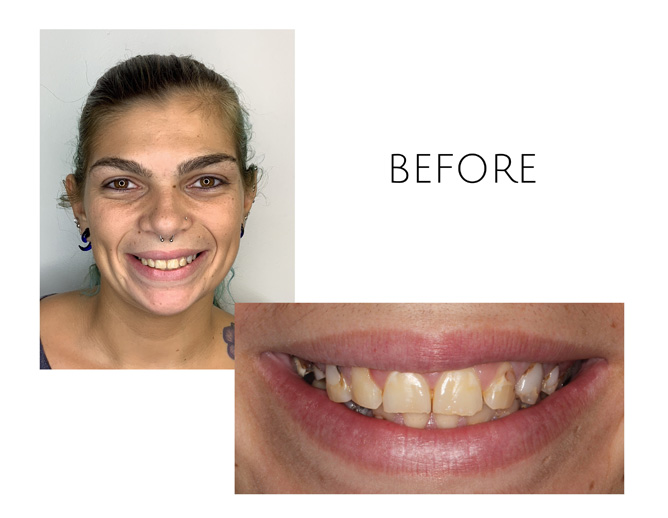 Smile Gallery Before Image