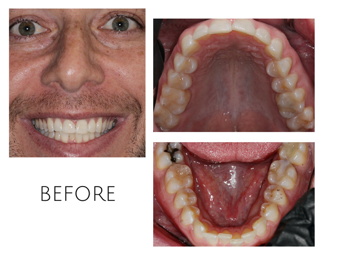 Smile Gallery Before Image