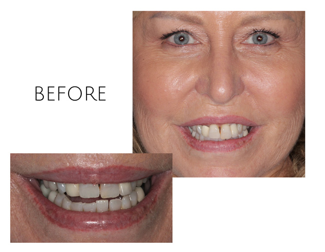 Smile Gallery Before Image