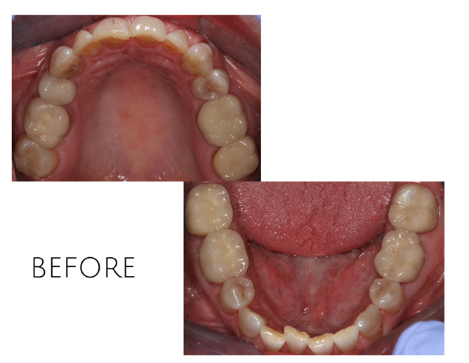 Smile Gallery Before Image