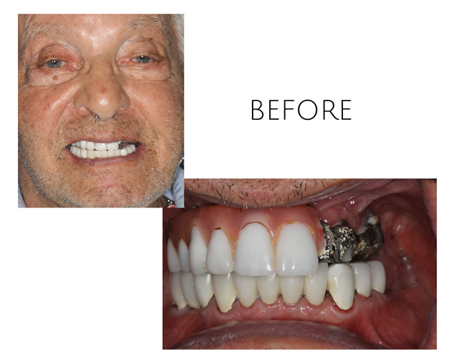 Smile Gallery Before Image