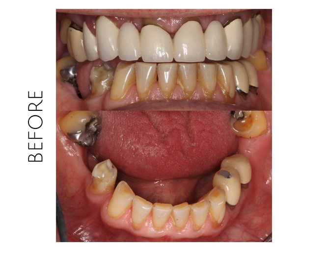 Smile Gallery Before Image