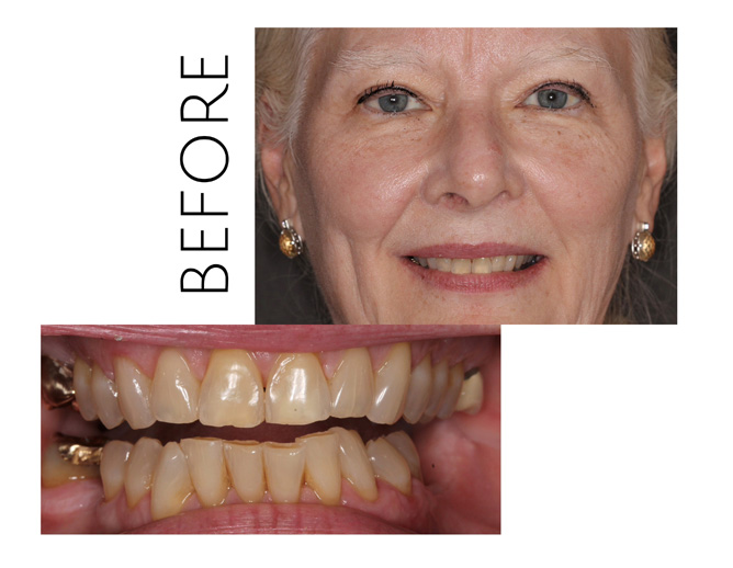 Smile Gallery After Image