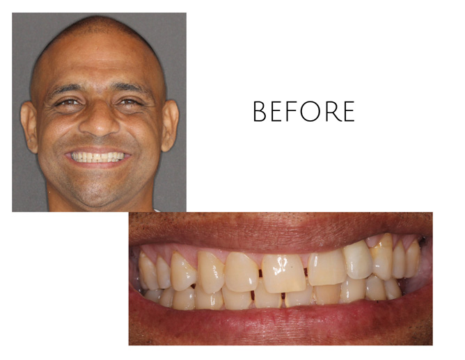 Smile Gallery Before Image