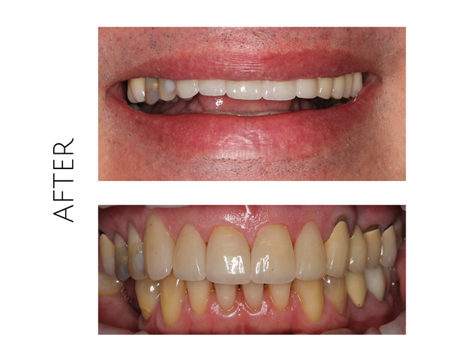 Smile Gallery After Image