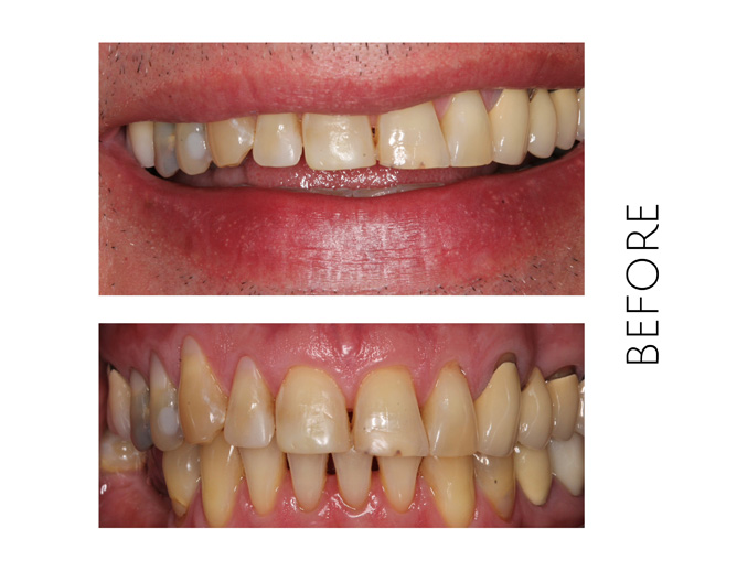 Smile Gallery Before Image