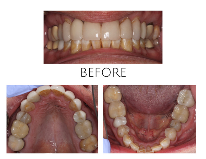 Smile Gallery Before Image