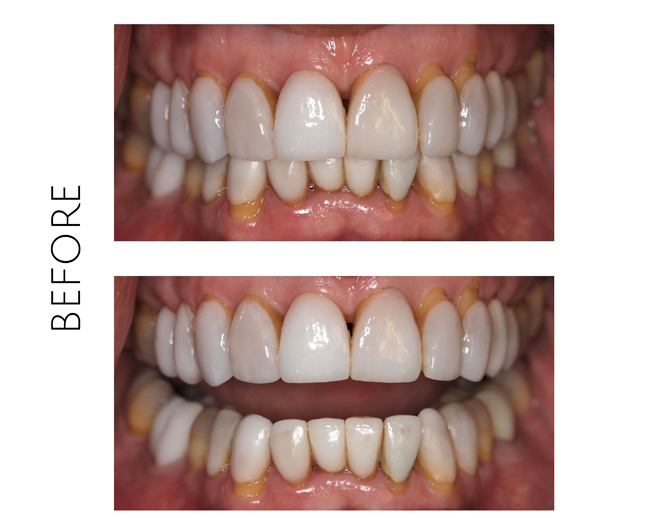 Smile Gallery Before Image