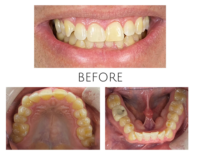 Smile Gallery Before Image