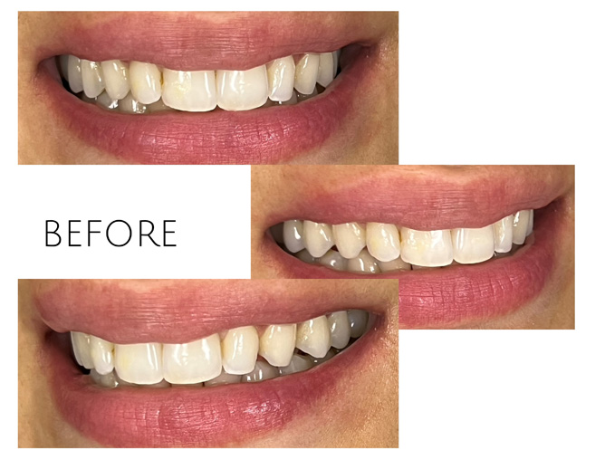 Smile Gallery Before Image