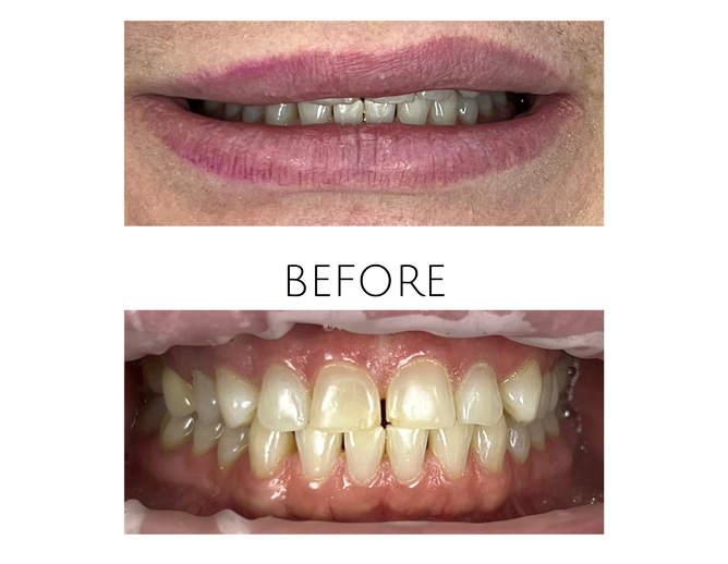 Smile Gallery Before Image