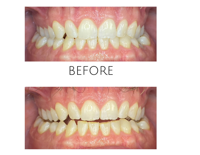 Smile Gallery Before Image