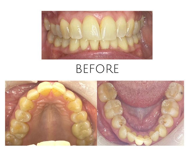 Smile Gallery Before Image