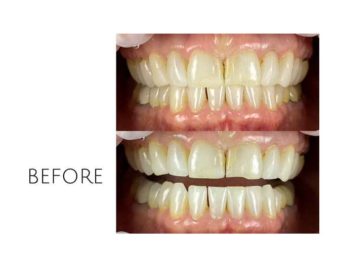 Smile Gallery Before Image