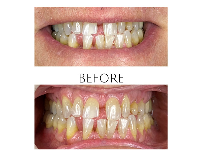 Smile Gallery Before Image