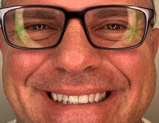 Smile Gallery Before Image