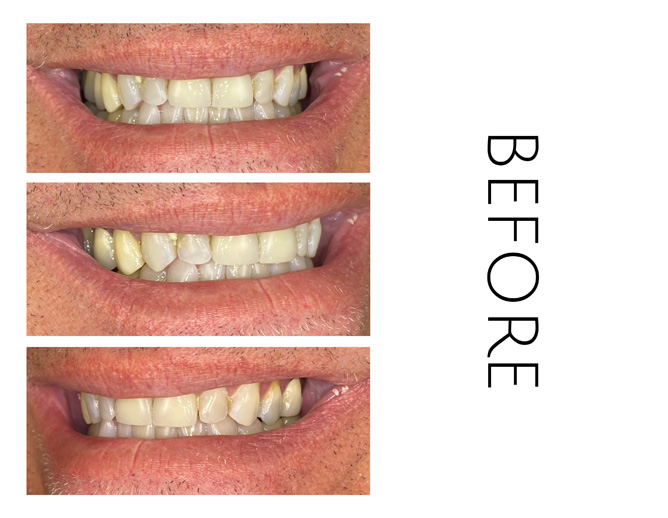 Smile Gallery Before Image