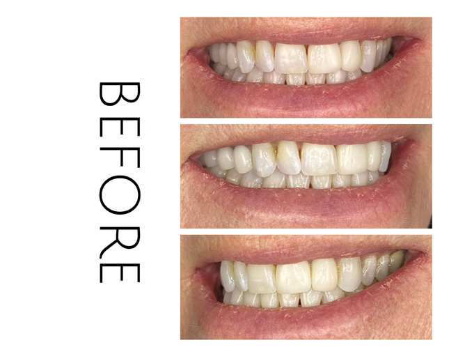 Smile Gallery Before Image