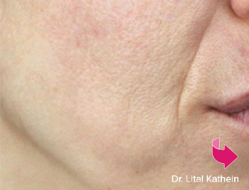 Smile Gallery Before Image