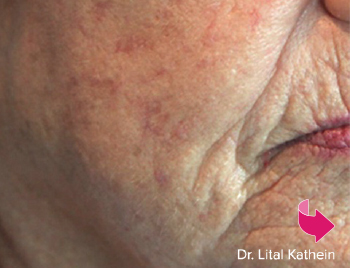 Smile Gallery Before Image