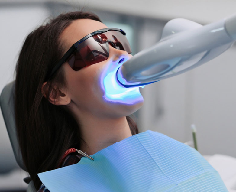 Teeth Whitening